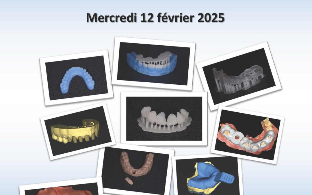 L’impression 3D au quotidien avec la chaine numérique CEREC®