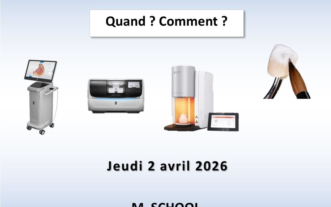 Les Zircones – Etes-vous prêts ?