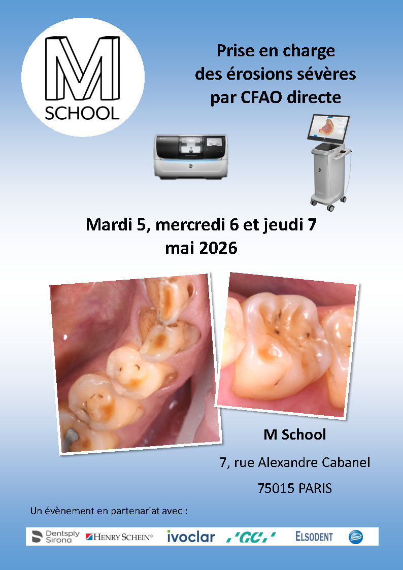 Prise en charge des érosions sévères par CFAO directe